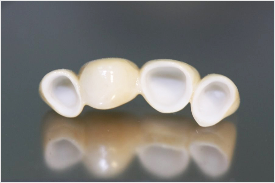 Циркониевые коронки на зубы 