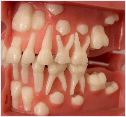 лечение зубов у детей 2.jpg